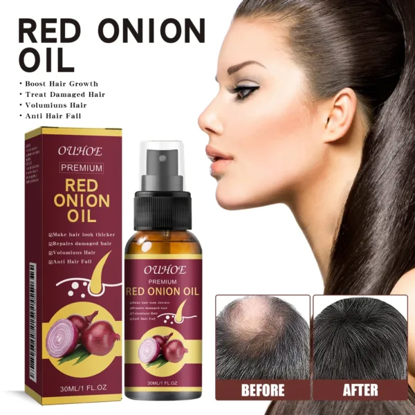 Red Onion Hair Growth Spray - Image 11