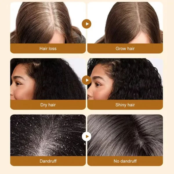 Batana Hair Growth Set - Image 3