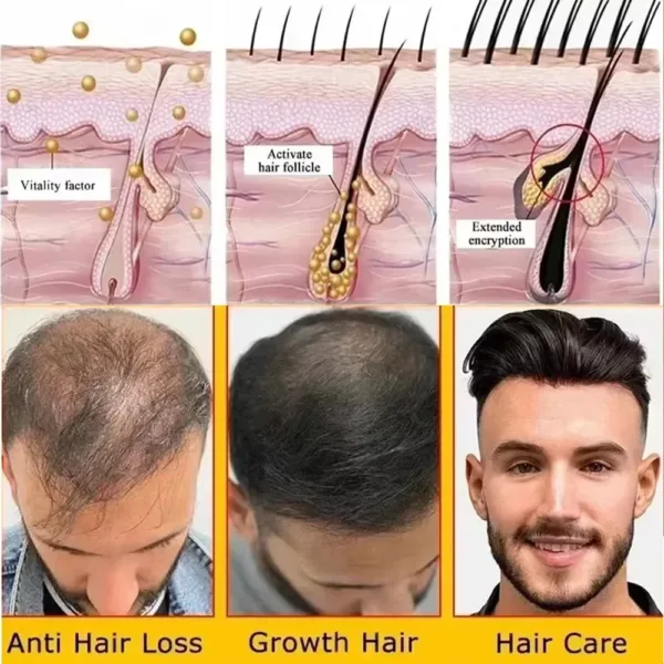 Batana Hair Growth Set - Image 5