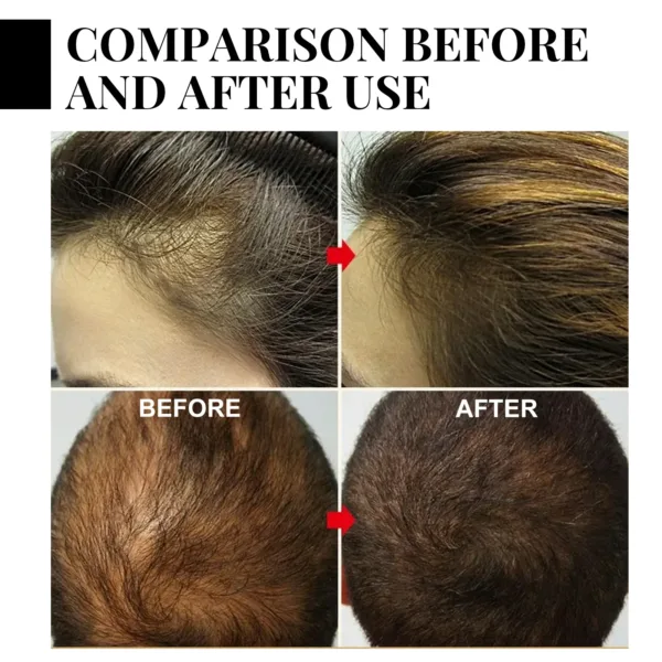 Batana Hair Growth Set - Image 22