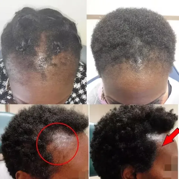 Batana Hair Growth Set - Image 2