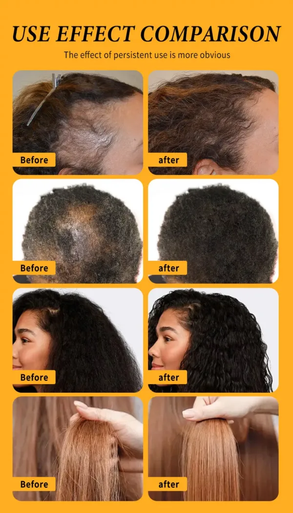 Batana Hair Growth Set - Image 18