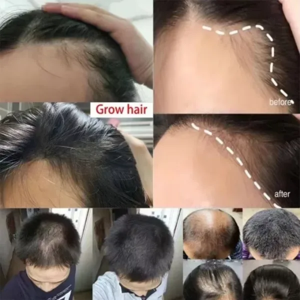 Batana Hair Growth Set - Image 4