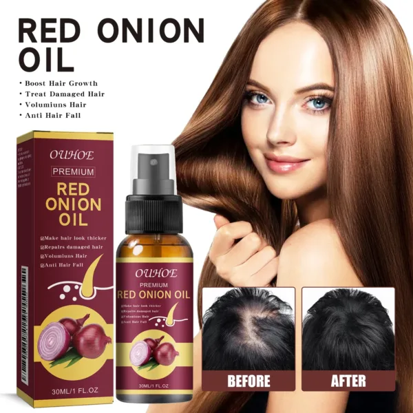 Red Onion Hair Growth Spray