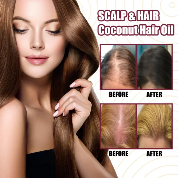 Red Onion Hair Growth Spray - Image 3
