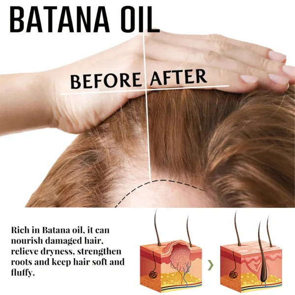 Batana Hair Growth Set - Image 20