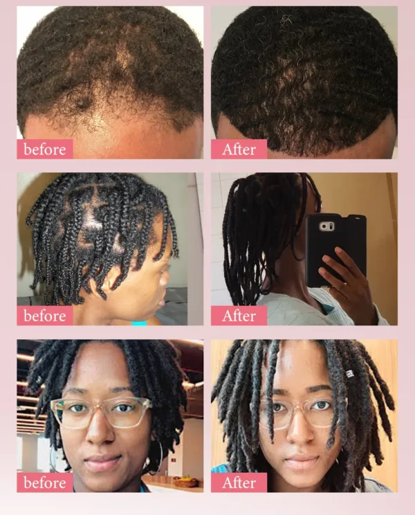 Batana Hair Growth Set - Image 19