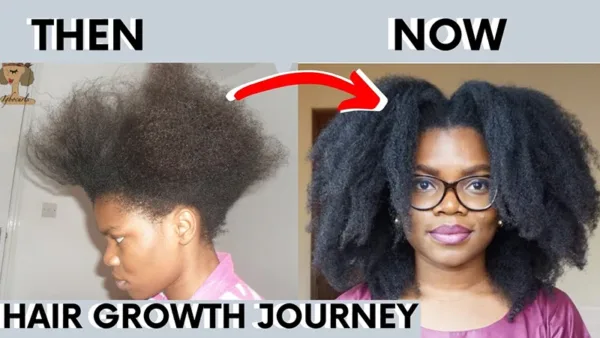 Batana Hair Growth Set - Image 11