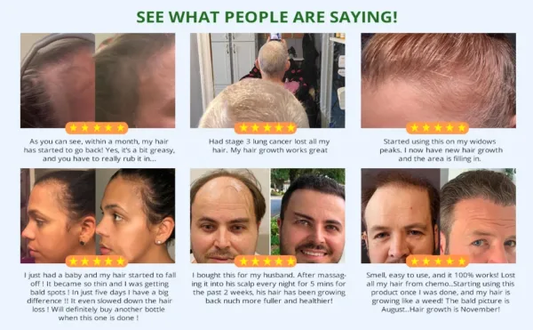 Batana Hair Growth Set - Image 10
