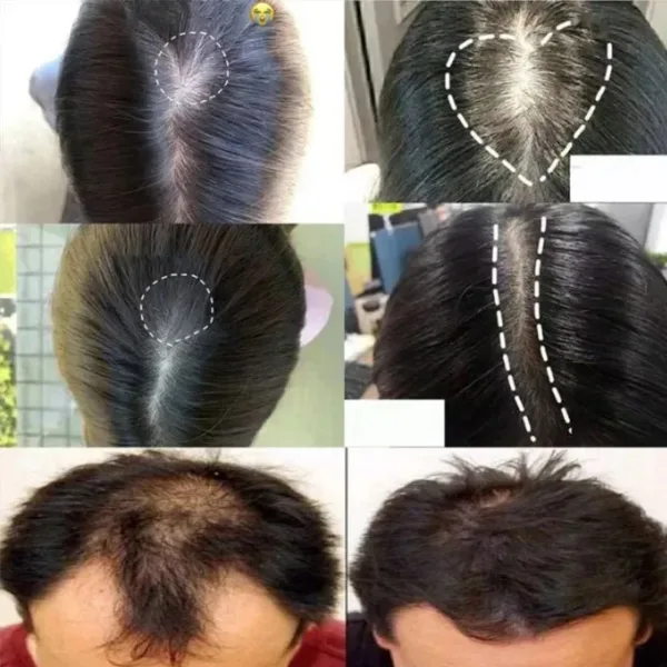 Batana Hair Growth Set - Image 13